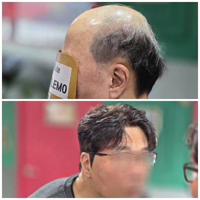 2961eb4a31001f6925336e693afdf87f_1773215333_6713.jpg 2961eb4a31001f6925336e693afdf87f_1773215333_6713.jpg