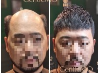 모히칸 짧은남자가발 STYLE